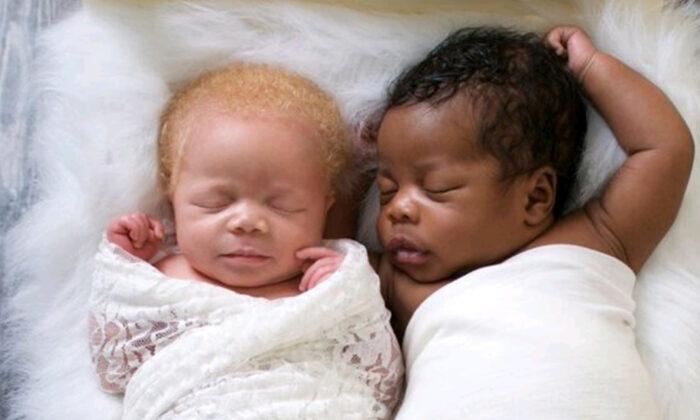 Photographer Gives Birth to Twins, One Black, the Other White, Takes Stunning Photos of Albino Daughter