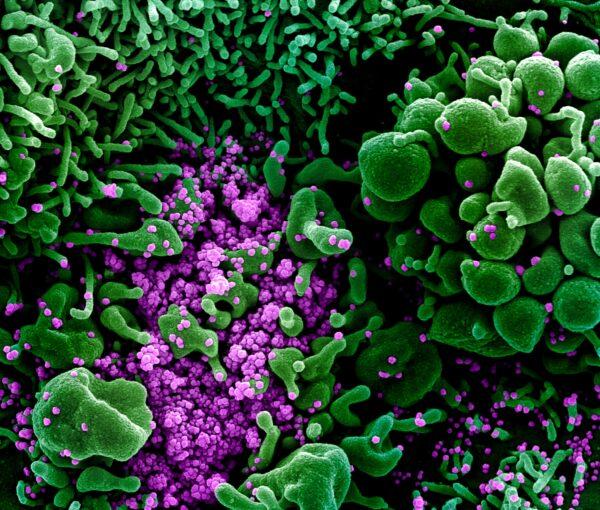 Colorized scanning electron micrograph of cell (green) heavily infected with CCP virus particles (purple), commonly known as SARS-CoV-2, isolated from a patient sample on March 16, 2020. (NIAID)