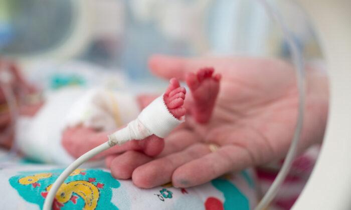 Miracle Baby Born 14 Weeks Premature Defies All Odds, Breathes on His Own 260 Days Later