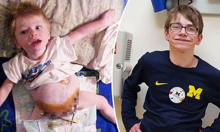 Boy Born With Organs Outside His Body Wasn’t Supposed to Survive, Celebrates High School Grad