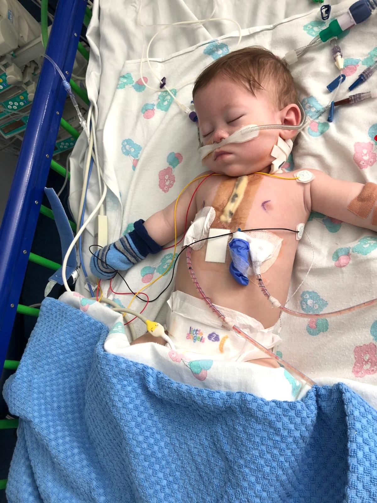 Riley has undergone two open-heart surgeries since his birth. (Caters News)
