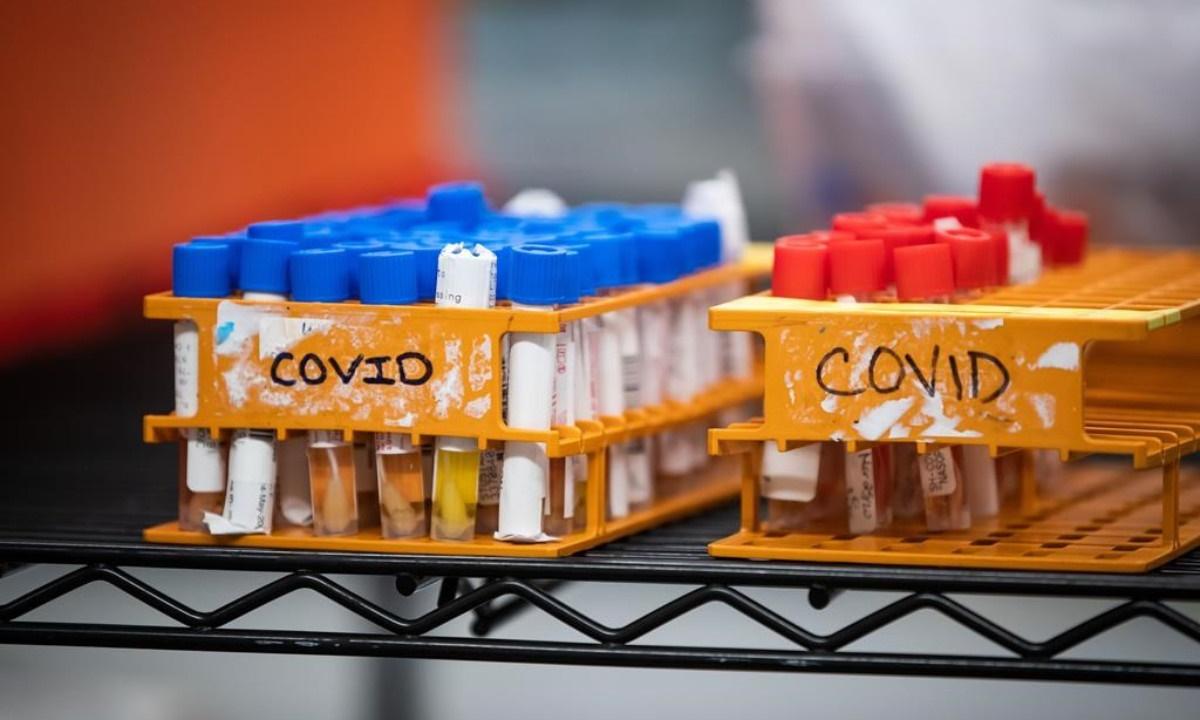 Specimens to be tested for COVID-19 are seen at LifeLabs after being logged upon receipt at the company's lab, in Surrey, B.C., on March 26, 2020. (Darryl Dyck/Canadian Press)