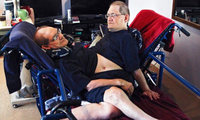World’s Longest-Surviving Conjoined Twin Brothers Die at 68
