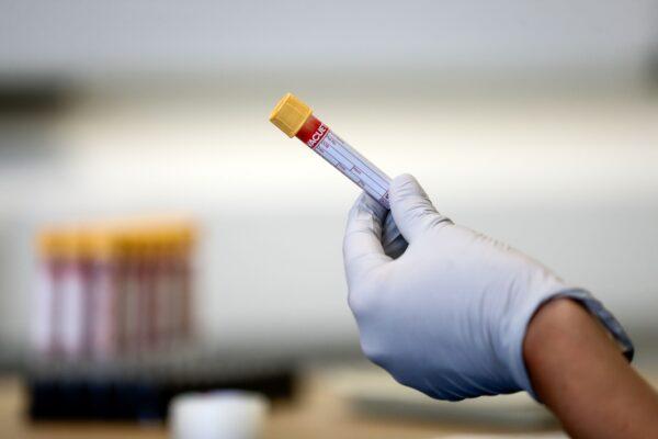 A paramedic holds a test tube containing a blood sample during an antibody testing program in Birmingham, Britain, on June 5, 2020. (Simon Dawson/POOL/AFP/Getty Images)