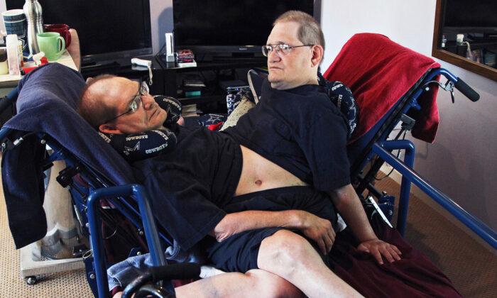 World’s Longest-Surviving Conjoined Twin Brothers Die at the Age of 68