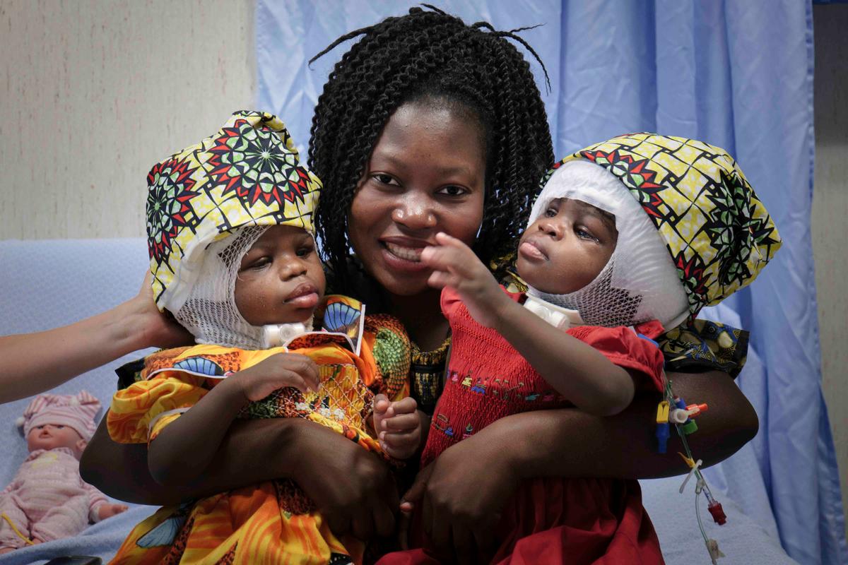 Ermine holds her twins, Ervina and Prefina, at the Vatican pediatric hospital, in Rome, June 30, 2020. (Bambino Gesu Hospital via AP)