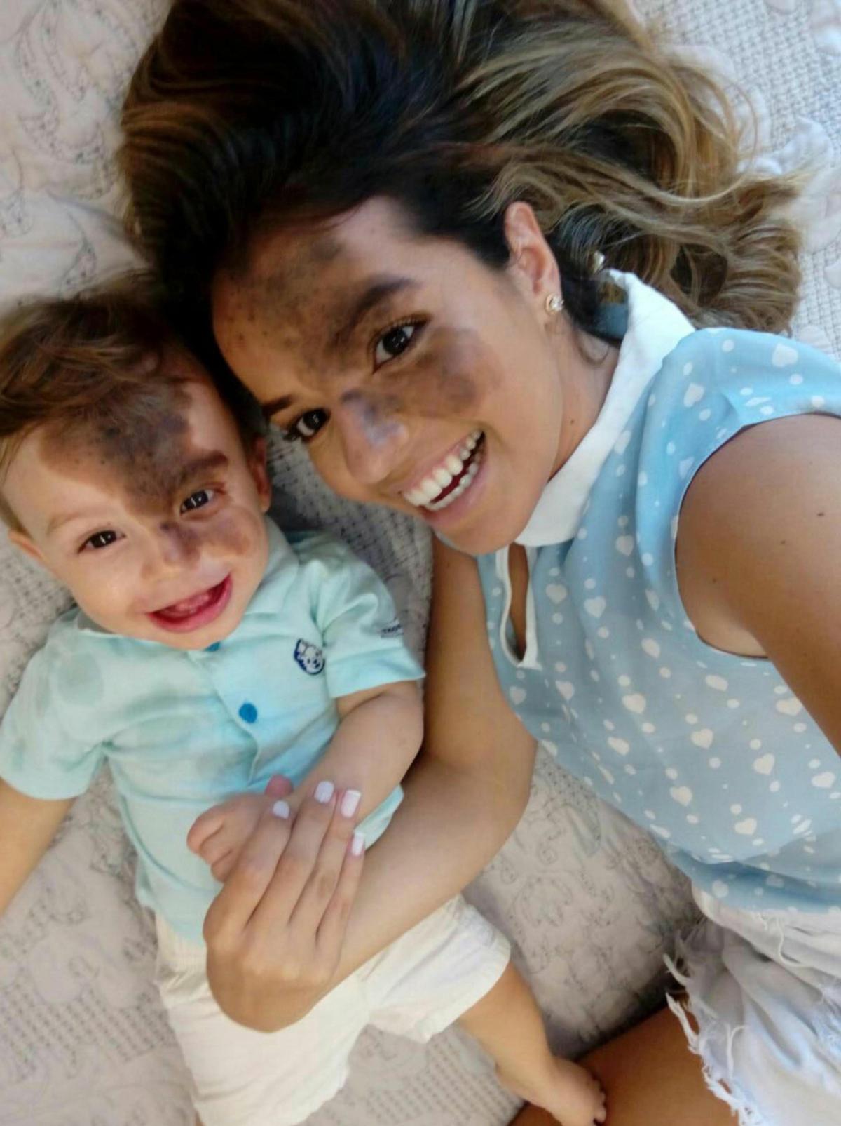 Carolina Giraldelli after she had her son Enzo's unique birthmark painted on her own face. (Caters News)