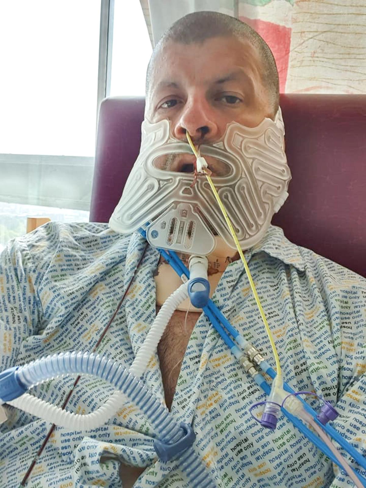 Darren Wilkinson, 51, a support worker, in hospital at Sheffield. (Caters News)