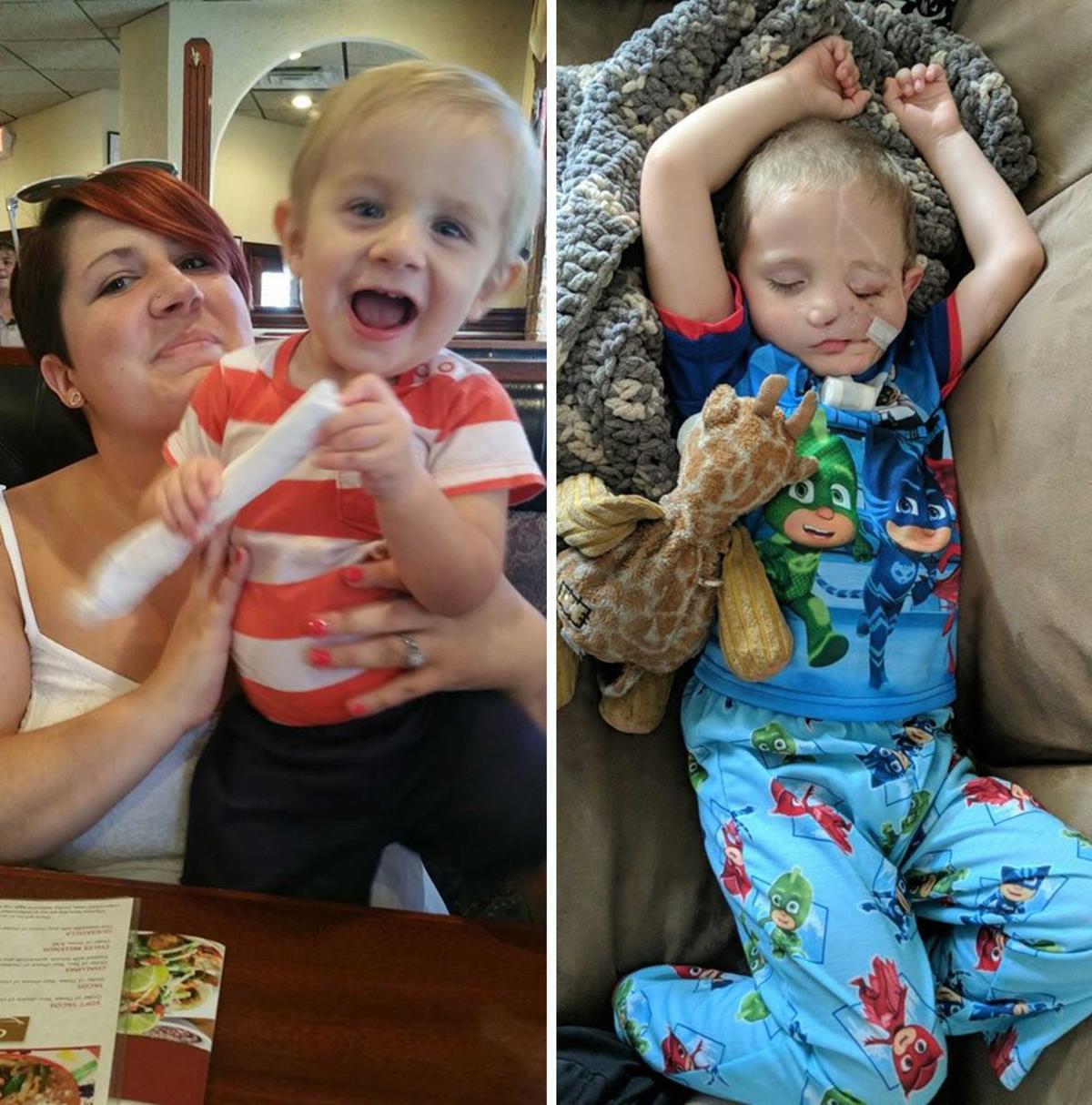 (L) Mother Brittany, 31, with Ryder before the attack; (R) Ryder Wells, 5, after the attack (Caters News)