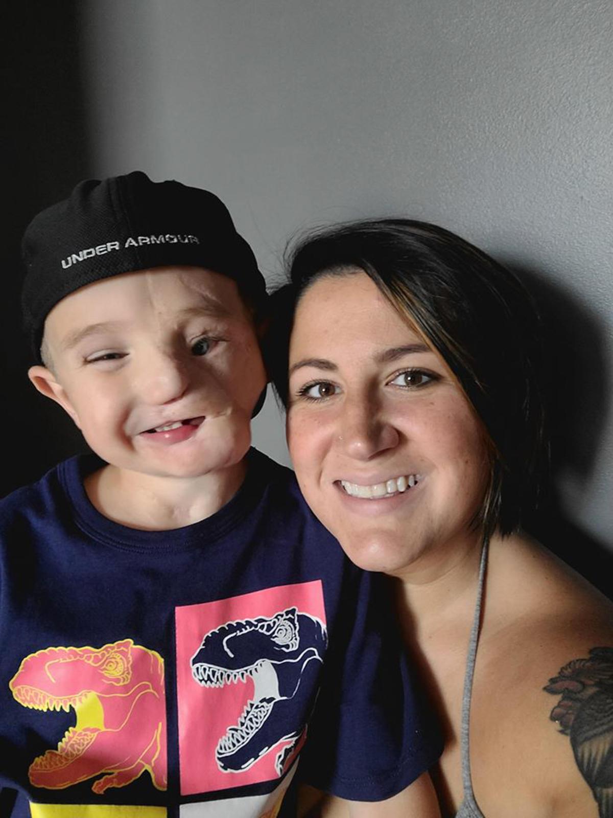 "The doctors said they would do what they could but we weren't expecting him to make it," Brittany said. "They said it's a miracle that he's still here because he was so small and the injuries were so severe." (Caters News)