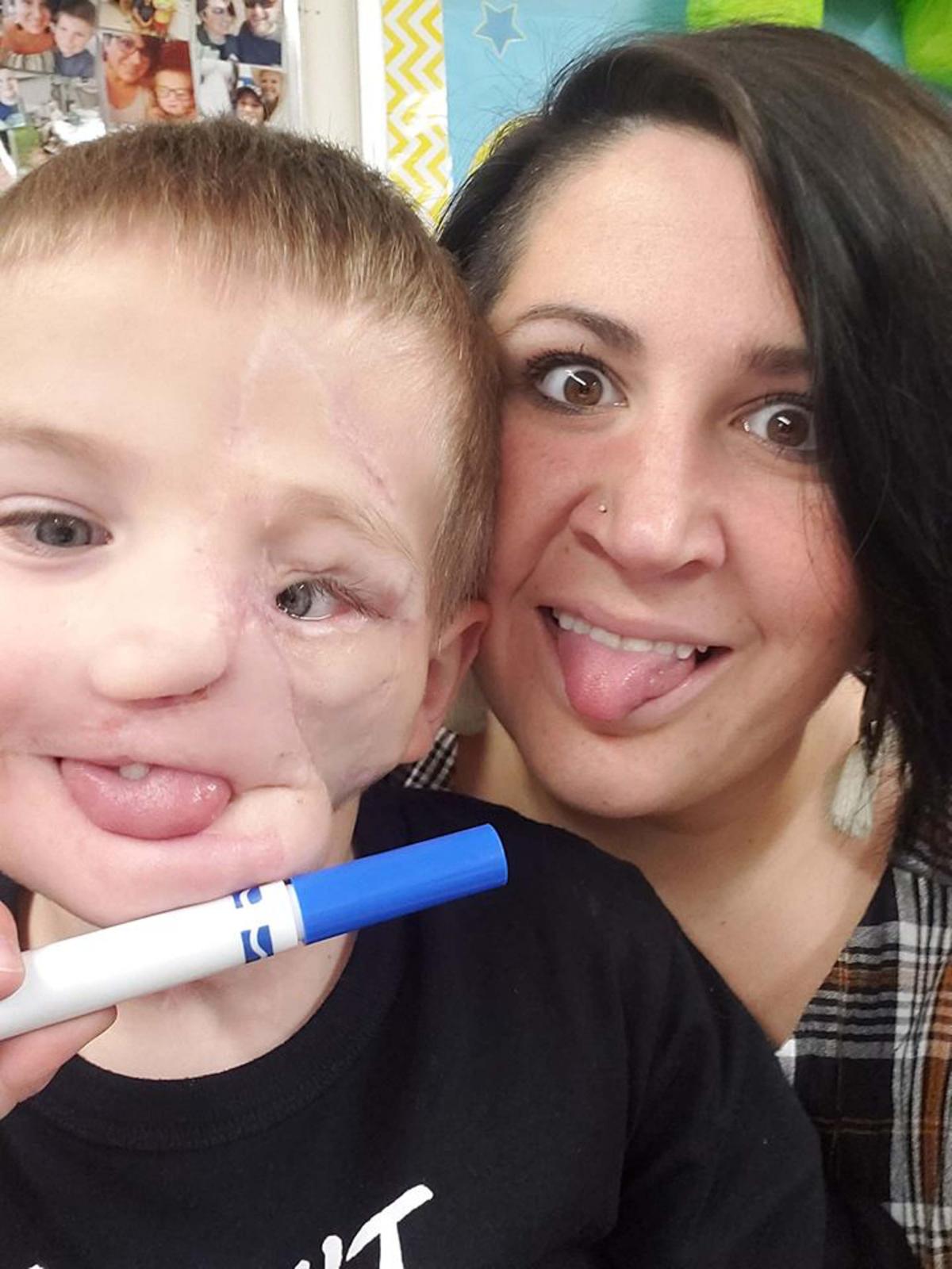 "He'll never look the same and we face a lot of obstacles," Brittany said. "The doctors said he would never be able to eat normally, he only has eight teeth now but he eats everything." (Caters News)