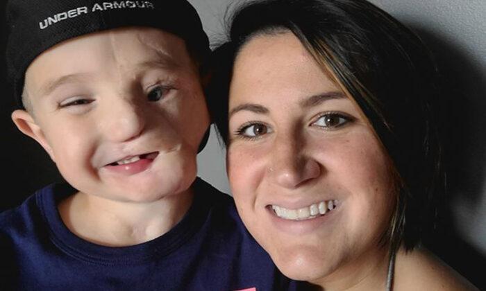 Heartbroken Mom’s 5-Year-Old Whose Face Was Ripped Off by Dogs Called ‘Monster’ by Strangers