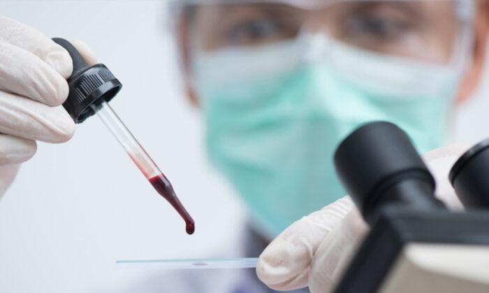 San Diego Researchers Say New Blood Test Can Detect Cancer 4 Years Before It Appears