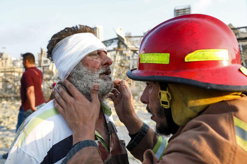 A wounded man is checked by a fireman near the scene of the explosion in Beirut on Aug. 4. (ANWAR AMRO/AFP via Getty Images)
