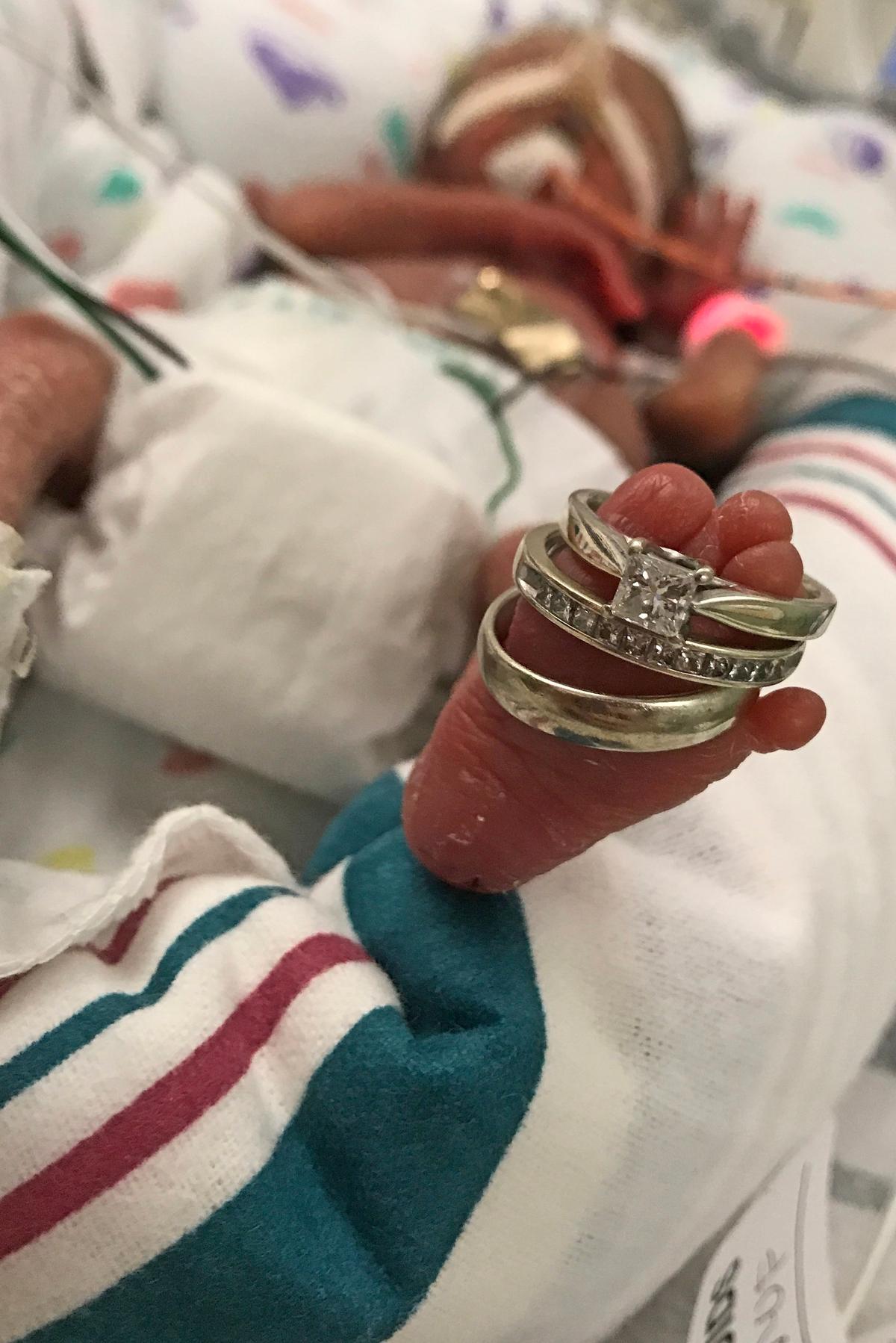 Tiny CJ in the hospital with Mom and Dad's rings around his foot (Caters News)