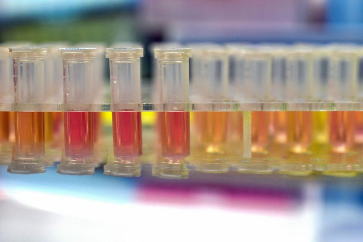 Samples from people to be tested for the new coronavirus at "Fire Eye" laboratory in Wuhan in China's central Hubei Province, on Feb. 6, 2020. (STR/AFP via Getty Images)
