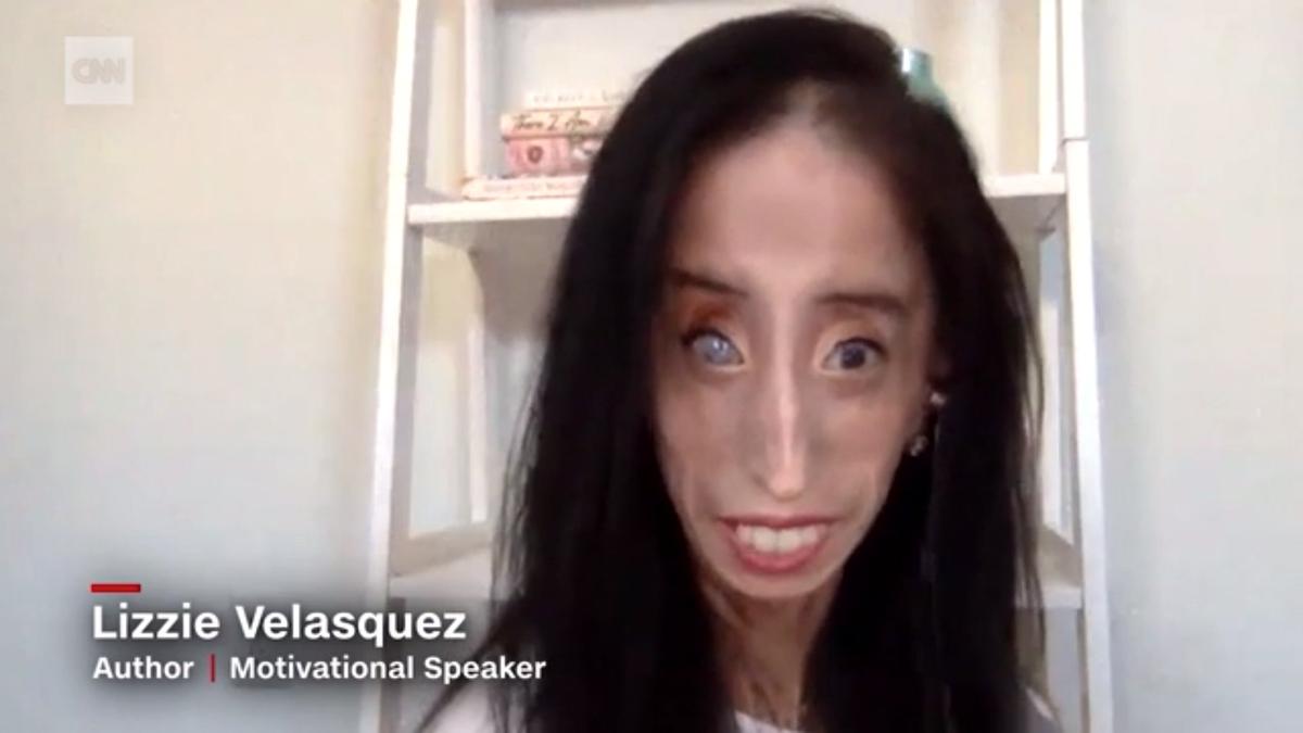 Lizzie Velasquez, a motivational speaker, went viral on TikTok in August after she found users on the app were sharing her photo as part of TikTok's "New Teacher Challenge." (CNN)