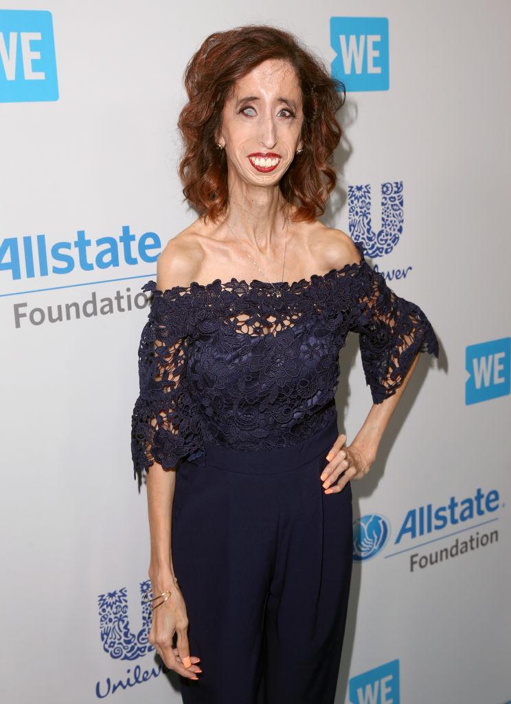 Motivational speaker/author Lizzie Velasquez attends WE Day California to celebrate young people changing the world at The Forum on April 27, 2017, in Inglewood, Calif. (Jesse Grant/Getty Images for WE)