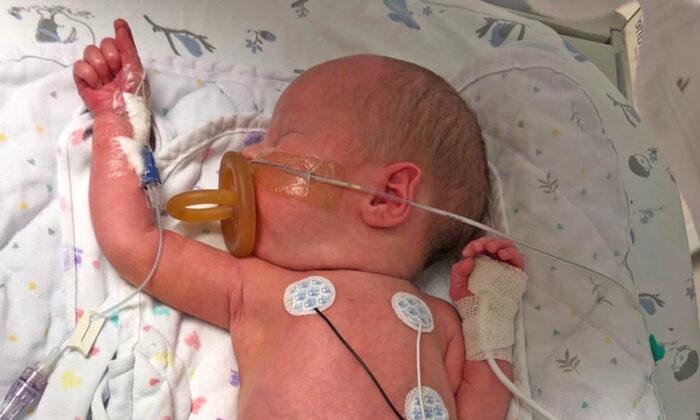 Baby Born With Small Intestines Outside His Tiny Body Has a Successful Surgery