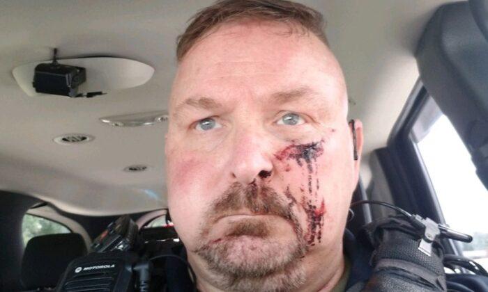 South Carolina Police Chief Stabbed With Icepick After Answering Door