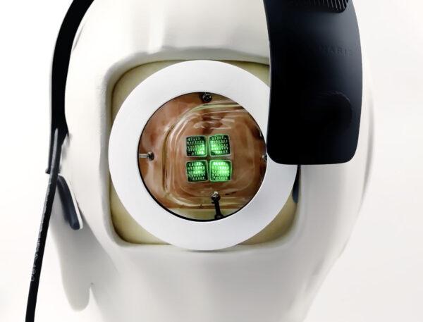 The Gennaris bionic vision system implant. (Monash University)