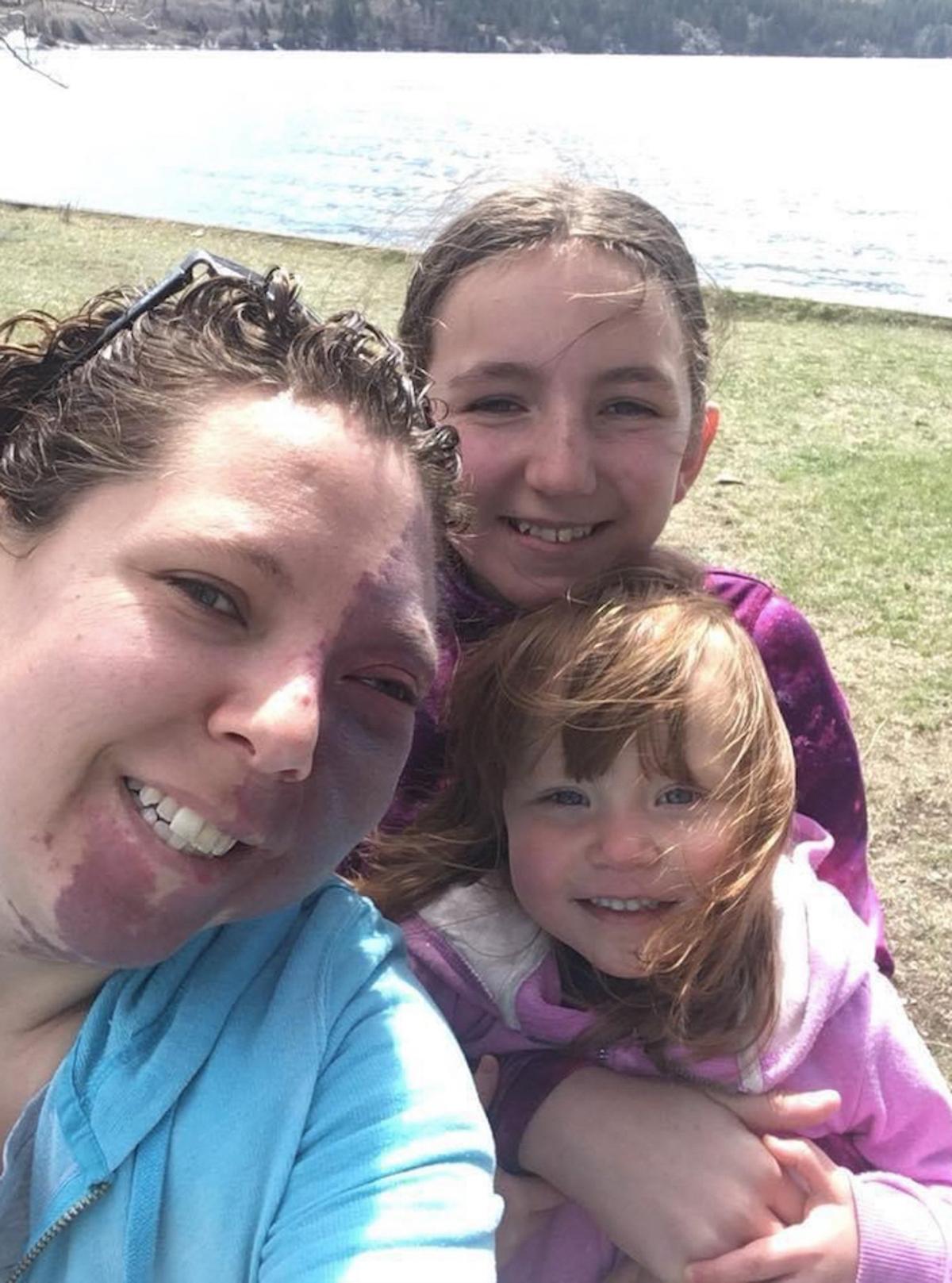 Chelsey Peat, 34, with her girls Athena, 13, and Zelda, 3. (Caters News)