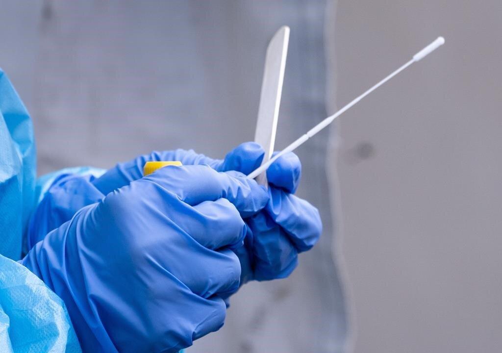 First Antigen Rapid Test for COVID-19 Gets Canadian Approval