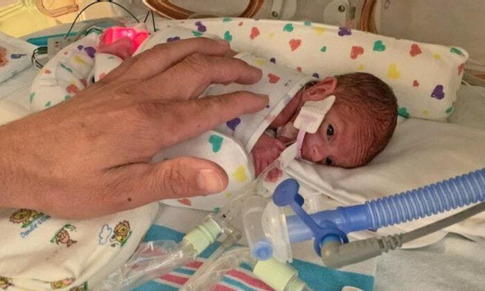 One-Pound ‘Micro-Preemie’ Born at 22 Weeks Goes Home After 133 Days in NICU