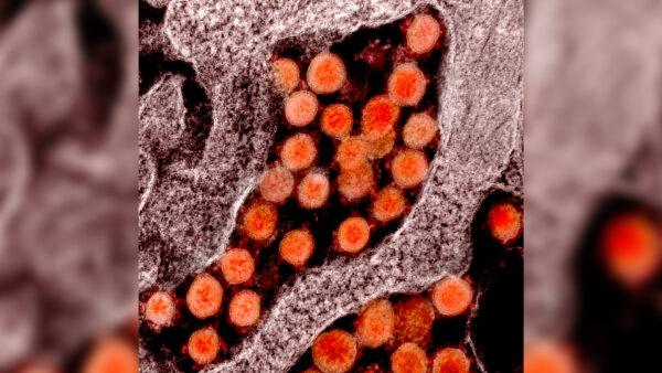  Transmission electron micrograph of particles of the CCP virus, or SARS-CoV-2 virus, isolated from a patient. (NIAID)