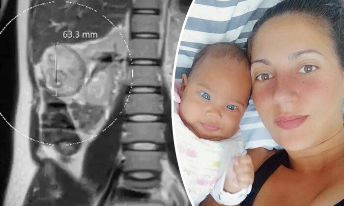 Mom Credits Baby for Saving Her Life After Doctors Spotted Grape-Sized Tumor During Pregnancy