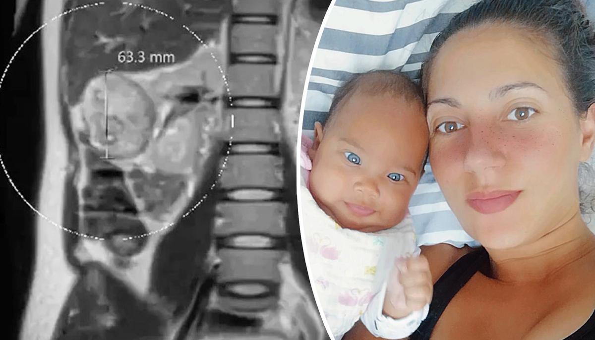 Mom Credits Baby for Saving Her Life After Doctors Spotted Grape-Sized Tumor During Pregnancy