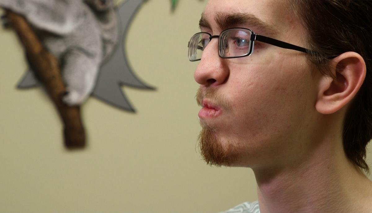 Groundbreaking Cleft Palate Surgery Changes 20-Year-Old Patient's Life