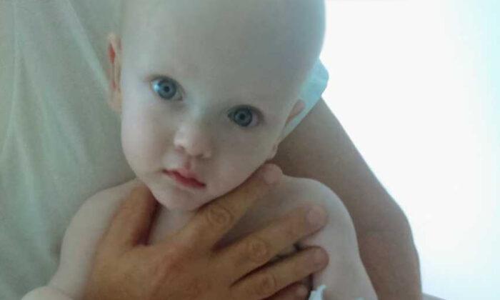 Abused Baby Who ‘Resembled an Alien’ Thrives With Loving Adoptive Family