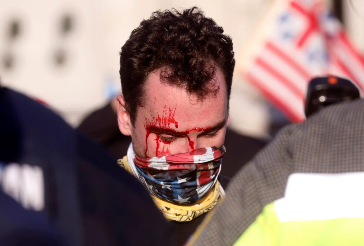 A President Donald Trump supporter is seen after being assaulted by reported Antifa members, in Washington on Nov. 14, 2020. (Leah Millis/Reuters)