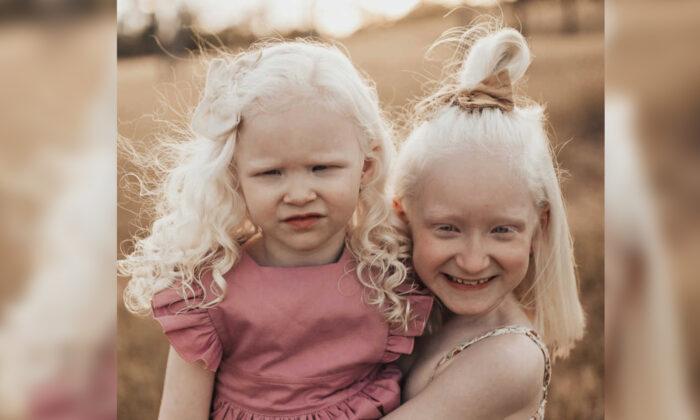 From Initial Fears to Developing a Fighting Spirit, Mom Raises Two Albino Daughters