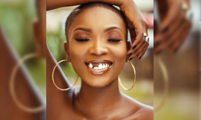 Model With an ‘Imperfect’ Smile Inspires People to Love Themselves and Find Beauty Within