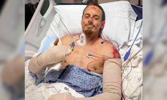 Georgia Man Saves His Whole Family From Housefire, Suffers Severe Burns to His Arms, Back