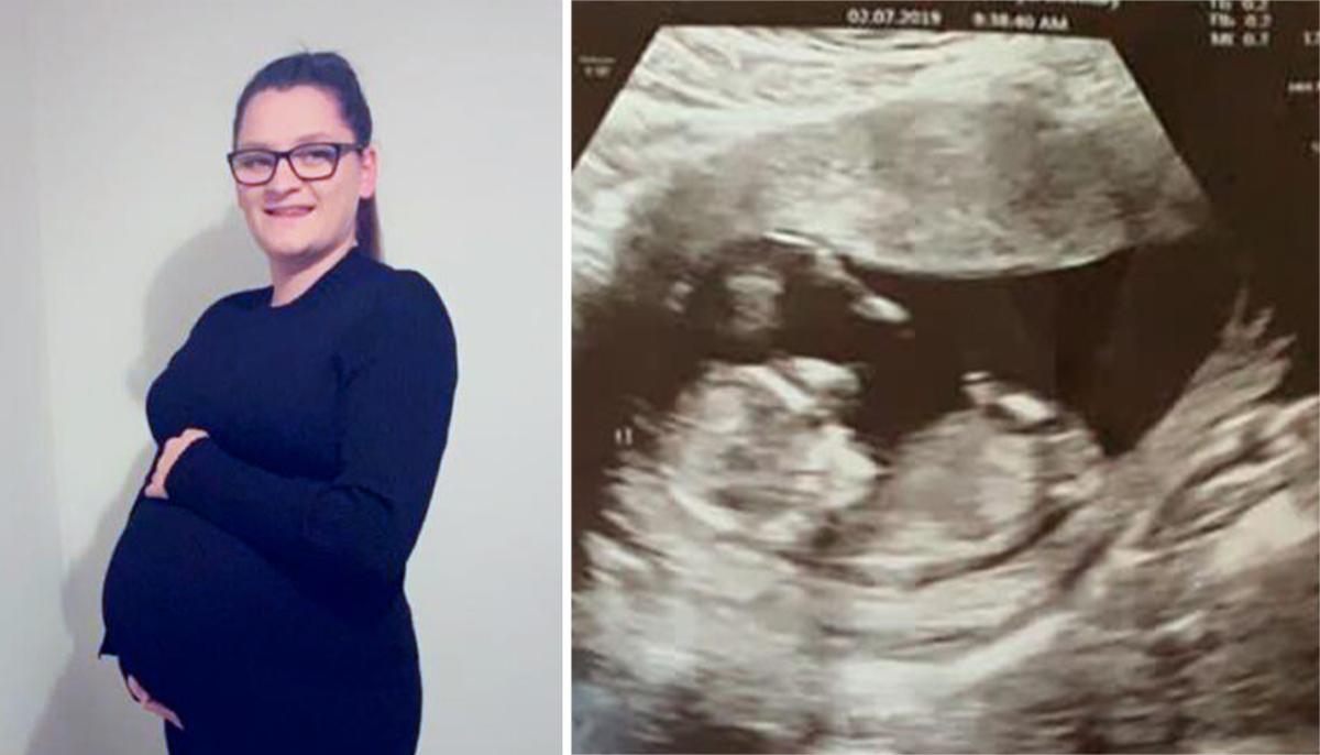 Pregnant Mom Carries Dead Unborn Baby for 10 Weeks to Give Twin Best Chance at Survival