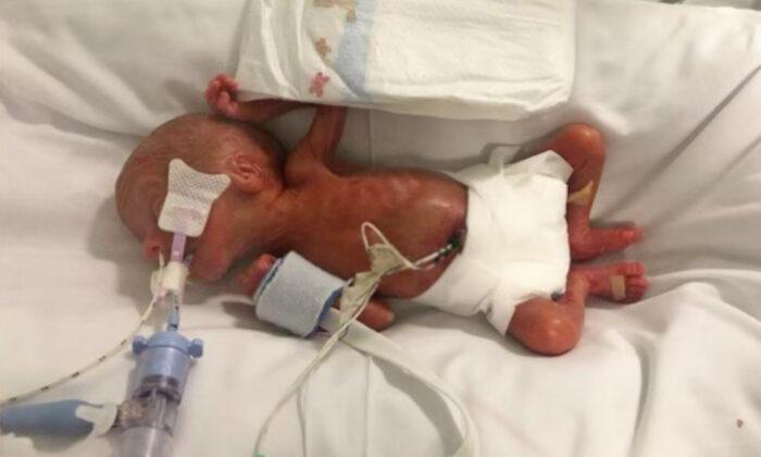 Parents of 1lb Preemie Who Were Forced to Say Goodbye Twice Prepare for His First Christmas