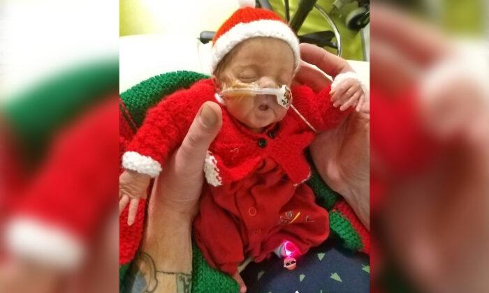 Preemie Turns One After Doctors Said Every Day for a Month She Wouldn’t Survive