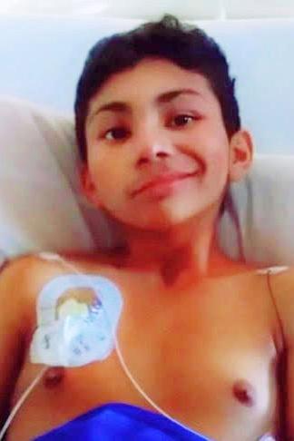 Daniel Onofre has tubes in his chest in preparation for a cancer treatment that includes stem cells being inserted in his lungs. (Courtesy of Wendy Onofre)