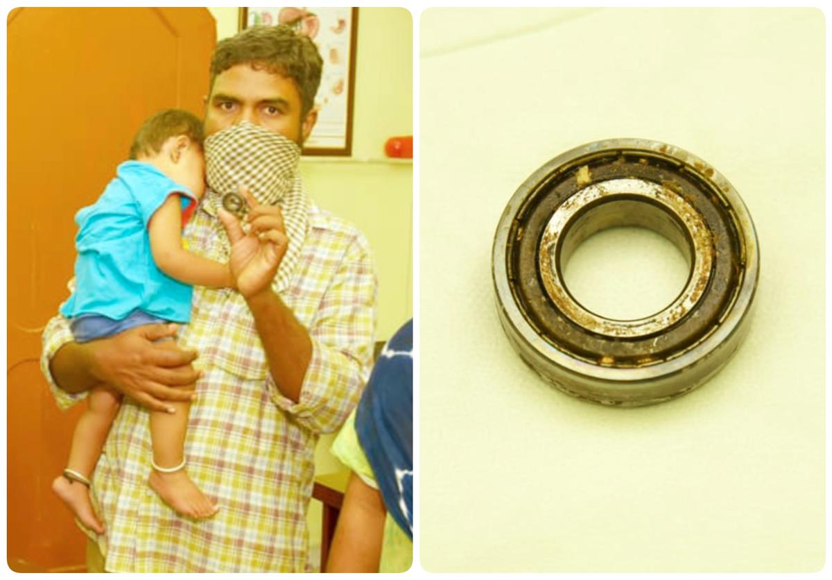 The baby's father showing the bicycle bearing that was removed from her throat after surgery. (Caters News)