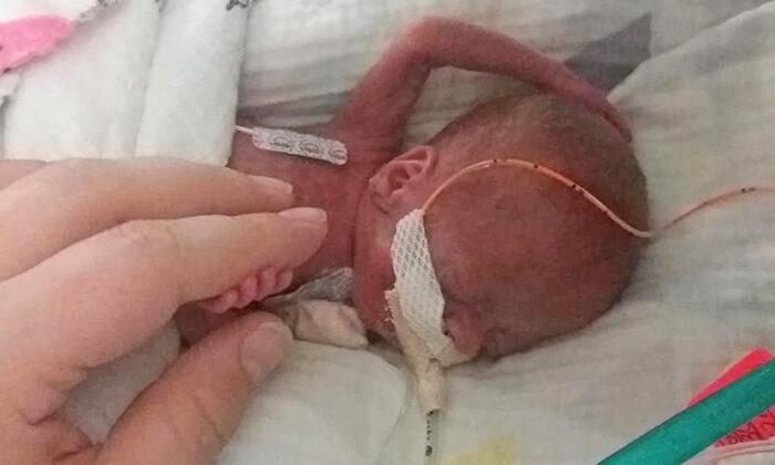 Baby Born at 21 Weeks Defies the Odds, Becomes One of the Youngest Babies to Survive