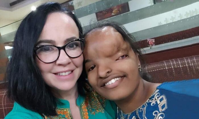 Teen With Facial Difference Almost Ages Out of Adoption, Until Adoptive Mom Arrives to Bring Her Home