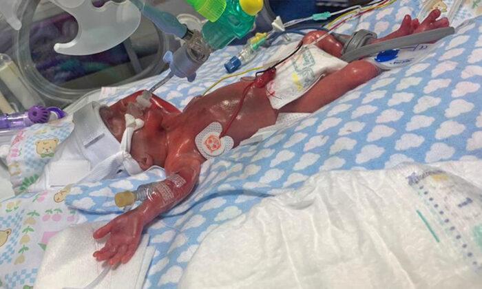 Miracle Baby Born at 23 Weeks as Mom Thought She Was Having a Miscarriage