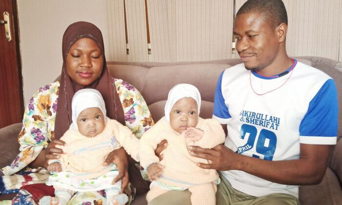 Conjoined Twin Girls Successfully Separated in Nigeria, Hospital Employs Struggling Parents
