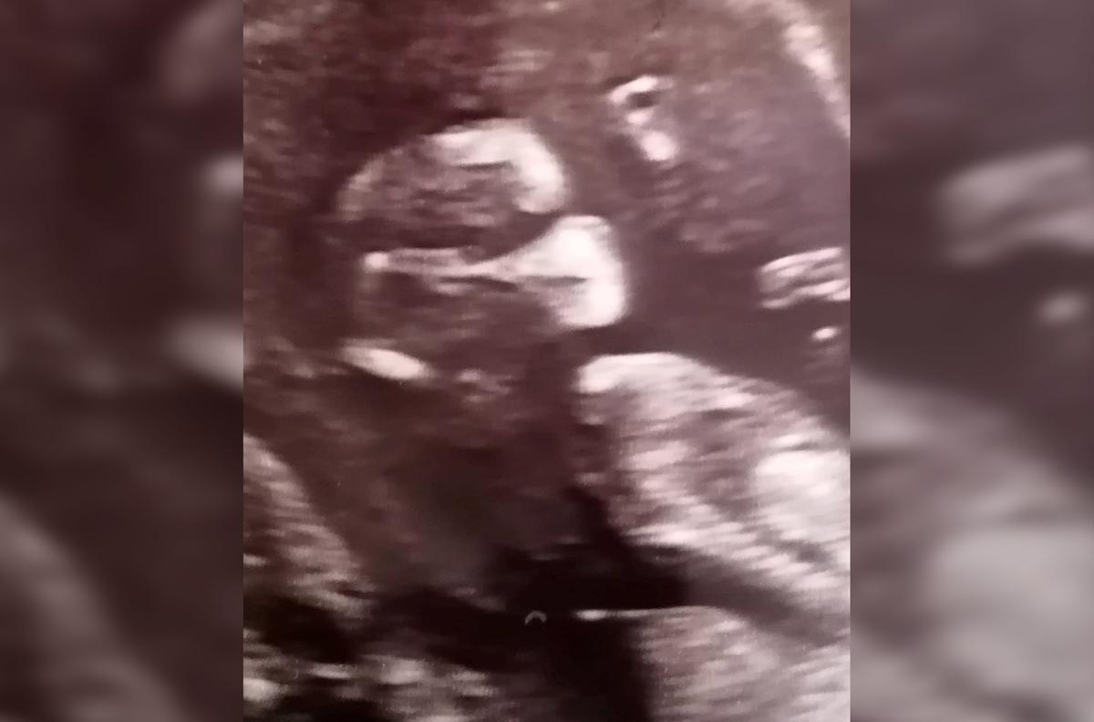 Detail of baby Spicer in her 12 week scan (Caters News)