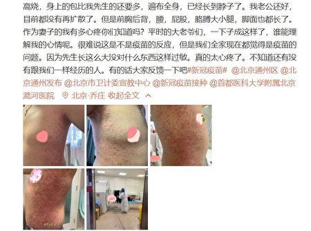 Screenshot of a post on Weibo revealing a Beijing resident's suspected adverse reactions after receiving a China-made COVID-19 vaccine.