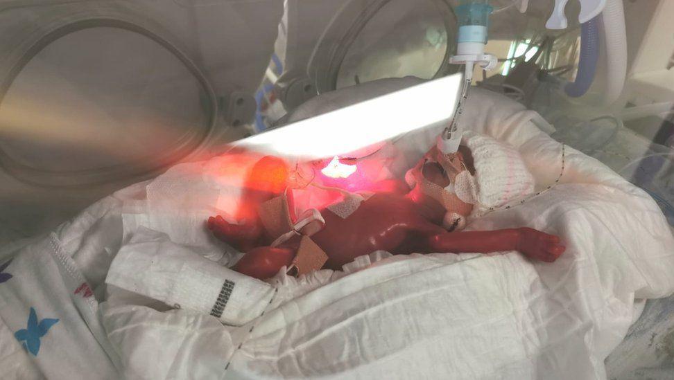 Baby Sofia in an incubator. (Courtesy of <a href="https://www.facebook.com/inbi4">Inars Birina</a>)