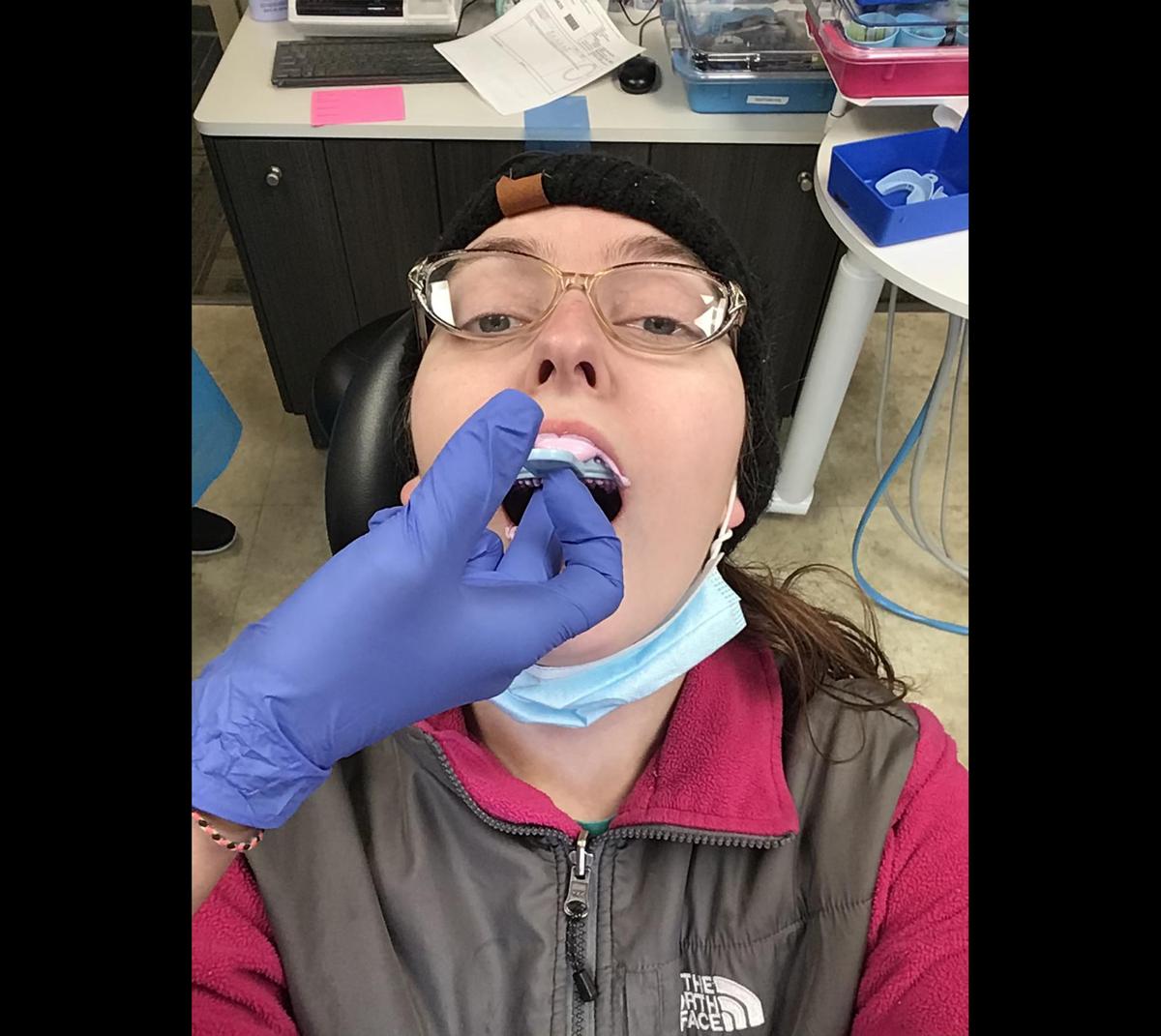 Dental staff take a molding of Victoria's teeth. (Courtesy of <a href="https://www.facebook.com/victoria.nowakowskishaniqua">Victoria Irene Nowakowski</a>)